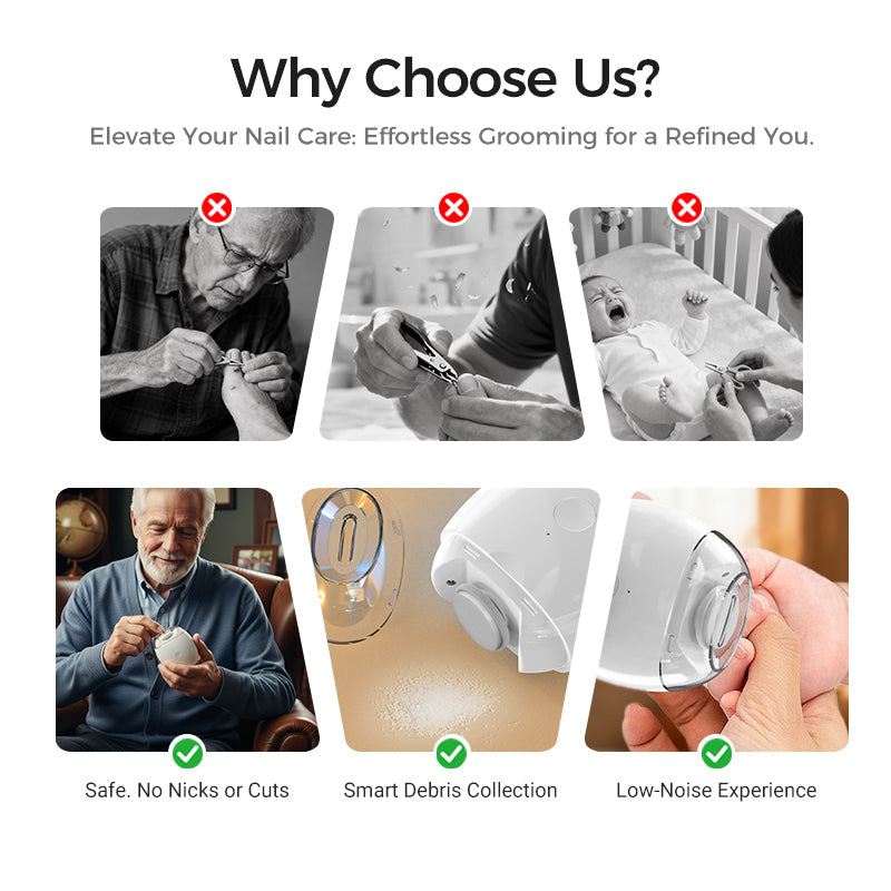 💅Last Day 60% OFF✨Electric Automatic Nail Clipper & Trimmer - Safety for the elderly and children