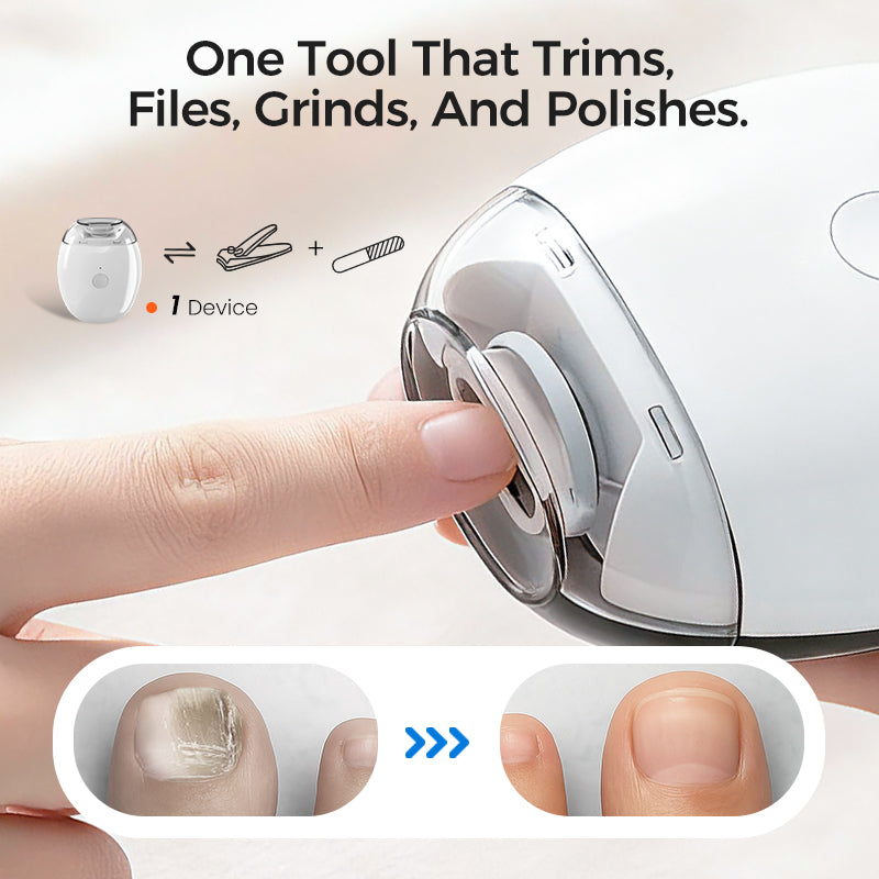 💅Last Day 60% OFF✨Electric Automatic Nail Clipper & Trimmer - Safety for the elderly and children