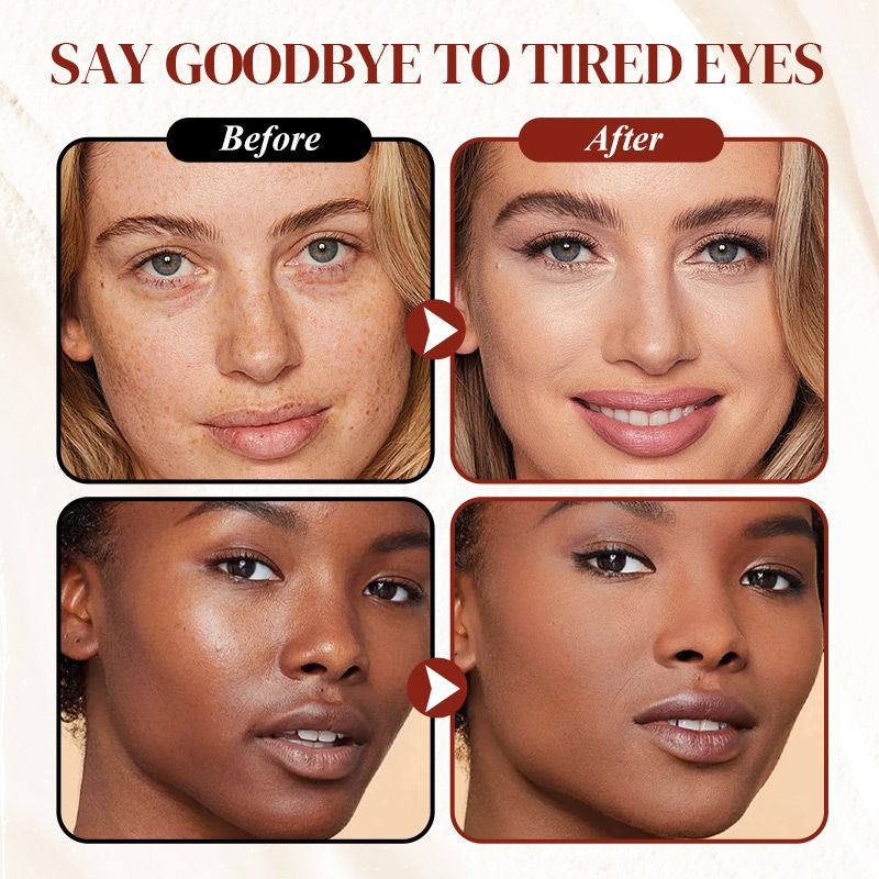 🔥Last Day Buy 1 Get 1 Free： 🎁Free Precision Concealer Brush!!💥2026 New Magic Colored Clay Undereye Corrector ✨